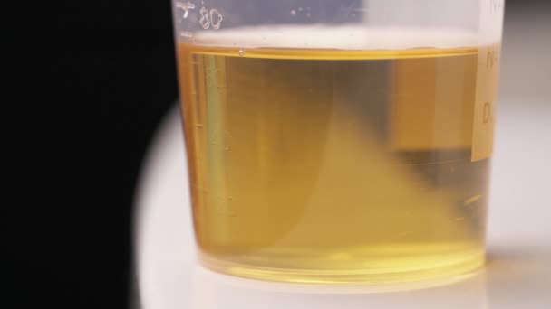 Prélèvement Échantillon Urine Avec Une Pipette Une Vidéo Démonstration Gros — Video