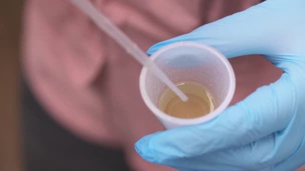 容器から尿を採取した青い医療用ラテックス手袋の手のトップビュービデオ — ストック動画