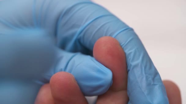 Läkare Tar Blodprov Från Patientens Finger Med Ett Kapillärrör — Stockvideo