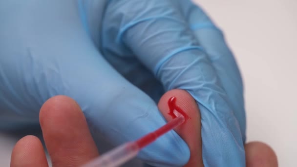 Pokaz Zbliżeniowy Próbką Krwi Pobraną Palca Pacjenta — Wideo stockowe