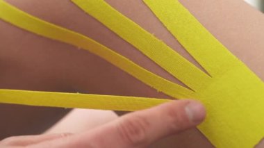 Bir terapistin hastaların bacağına ince çizgili Kinesio bandı bantladığı yakın çekim görüntüsü. Diz ağrısı alternatif terapisi