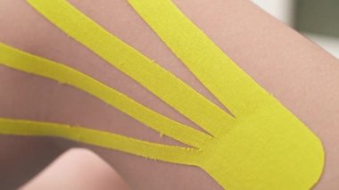 Kinesio bantlı bir hastanın bacağının alt üst görüntüsü. Ağrı tedavisi. Spor ve rehabilitasyon