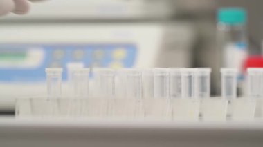 Bir laboratuvar teknisyeni mikro plaka analizi için insan biyolojik numunesiyle mini bir test tüpü alıyor..