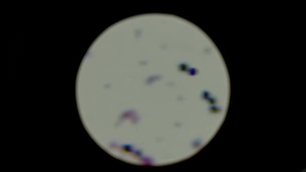 使用显微镜进行分析 显微镜下滑行上的细菌构成了葡萄球菌微生物的一个大领域 — 图库视频影像