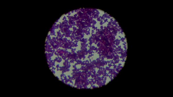 生物試料培養の汚れグラムは 光顕微鏡下でグラム陽性黄色ブドウ球菌で染色されます 微生物学 — ストック動画