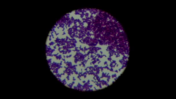 ヒトの生体試料培養のスミアグラムの染色体は 光顕微鏡下での二核分裂細菌クラスターにおけるグラム陽性黄色ブドウ球菌である — ストック動画