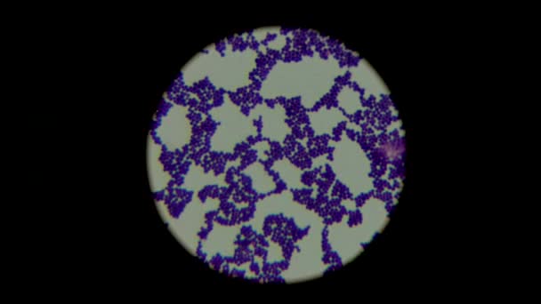 Cercetarea Probei Biologice Umane Folosind Microscopul Identificarea Biochimică Bacteriilor Stafilococ — Videoclip de stoc