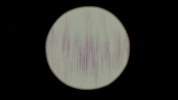 显微镜下念珠菌孢子的特征 实验室和医学研究概念 — 图库视频影像