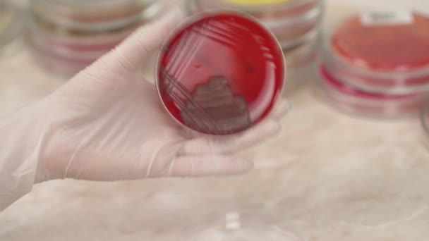 Detailní Záběr Ruky Lékařských Techniků Držících Petriho Misku Mikrobiologické Laboratoři — Stock video