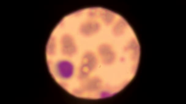 显微镜下可见的血细胞 人类生理学 生物技术 — 图库视频影像