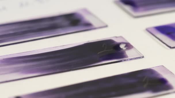 Зліва Направо Знімок Мікроскопічних Слайдів Зразками Використання Реагенту Тестування Біологічних — стокове відео