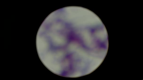 Фокус Змінює Вигляд Бактерій Під Мікроскопом Стафілококові Мікроорганізми Концепція Лабораторних — стокове відео