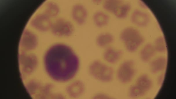 Клітини Крові Під Мікроскопом Освіти Людської Тканини Біотехнології Наука Медицина — стокове відео