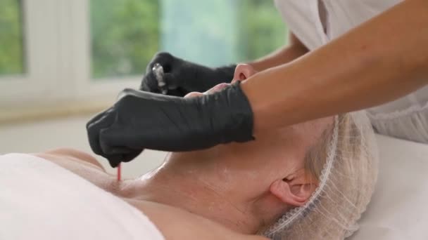 マスクで患者の顔の皮膚をカバーするために綿の芽を使用してプロの美容師の側面図 審美的な医学の概念 — ストック動画