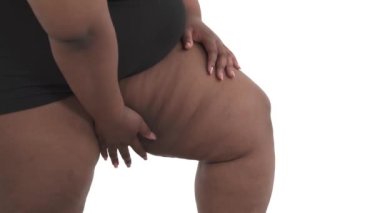 Beyaz arka planda izole edilmiş iç çamaşırlı Afro-Amerikan obez kadının sarkık bacakları.