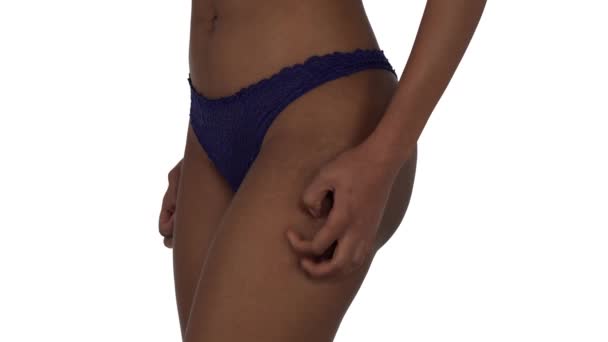 肌の刺激を持つ若いラテン女性 腰を掻いている女の横顔 スキンケアの概念 白地に隔離された — ストック動画
