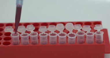 Deney tüplerinde menteşe üstü şişeleri kırmızı sıvıyla dolduran tanımlanamayan laboratuvar asistanı. Kan analizleri. Sağlık ve tedavi kavramı