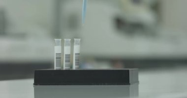 Mikro boru kullanarak test tüplerindeki sıvı toplama işlemini temizle. Tıp laboratuarında reaksiyonlar karıştırılıyor. Sağlık sigortası konsepti. Bulanık arkaplan