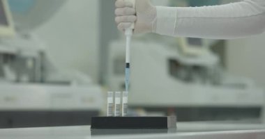 Kimyasal reaktörü mikro pipet kullanarak test tüplerine karıştıran tanınmayan bir tıp çalışanı. Laboratuvar analizi. Sağlık sigortası konsepti. Bulanık arkaplan