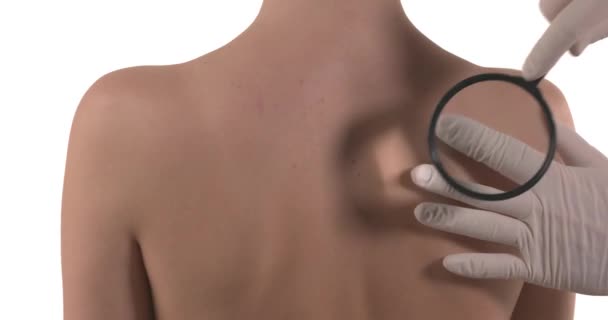 白种人妇女背部的静态拍摄与痣和医生的手在手套触诊胎记的焦点 专家的皮肤病检查因白人背景而被隔离 — 图库视频影像