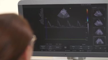 Ultrason çeken profesyonel bir kadın doktorun yakın plan fotoğrafı. Karın ultrasonu. Pelvik organlar monitörde. Sağlık hizmetleri kavramı