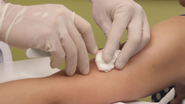 Egy Közeli Kép Egy Orvosról Aki Bőr Vérömleny Elvezetését Végzi — Stock videók