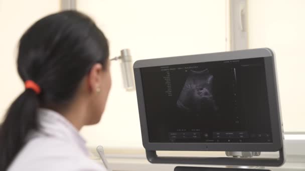 Zbliżenie Profesjonalnej Lekarki Patrzącej Monitor Maszyny Medycznej Podczas Badania Ultrasonograficznego — Wideo stockowe