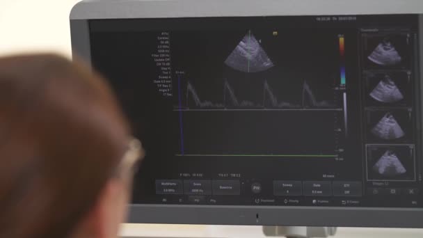 Zbliżenie Profesjonalnej Lekarki Robiącej Badania Ultrasonograficzne Usg Brzucha Organy Miednicy — Wideo stockowe