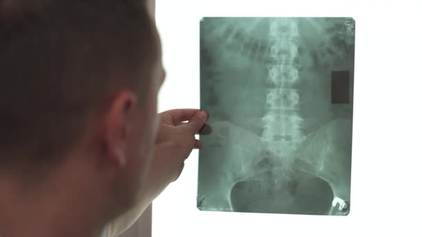 Närbild Läkare Hand Hålla Röntgen Bäckenben Och Mänsklig Ryggrad Röntgenundersökning — Stockvideo