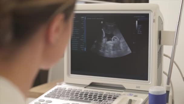 一名女医生在医院为孕妇做超声波扫描的特写镜头 聚焦在超声波扫描仪的图像监控 选择性对焦射击 — 图库视频影像