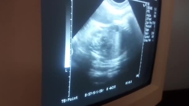 Ultraschall Zur Kontrolle Der Entwicklung Des Babys Bauch Der Mutter — Stockvideo