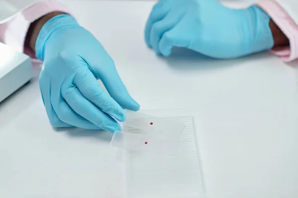 Hands Laboratory Worker Taking Glass Plates Drops Bllod — Stok fotoğraf