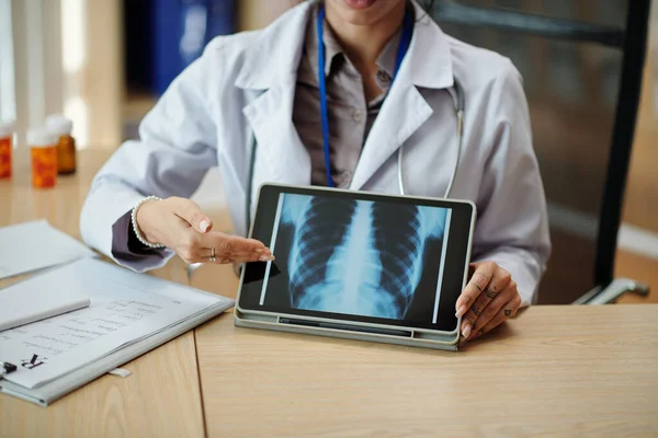 画面上の肺のX線イメージのタブレットコンピュータを示す一般開業医 — ストック写真