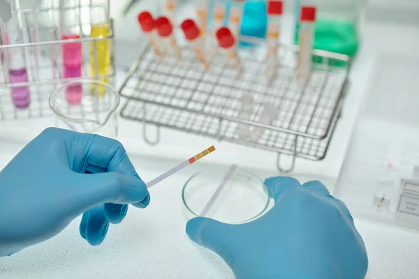 在临床实验室进行的实验中 化学家用手套手在培养皿上握有Ph酸的纸指示剂的特写 — 图库照片