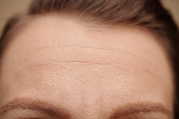 Closeup Image Mature Woman Forehead Rows — Stock Photo, Image
