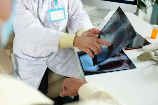 Dłonie Plmonologa Wskazujące Prześwietlenia Płuc Podczas Wyjaśniania Pacjentowi Guza — Zdjęcie stockowe