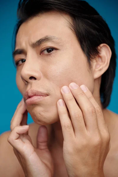 Man Tillämpa Akne Behandling Ansiktet Efter Att Tagit Morgondusch — Stockfoto