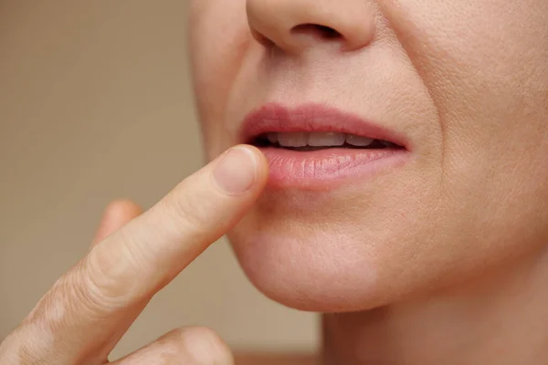 Frau Mittleren Alters Wendet Feuchtigkeitsspendende Behandlung Auf Den Lippen — Stockfoto