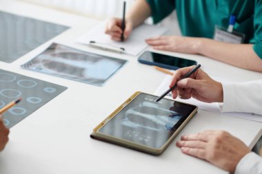 Cerrah ve akciğer uzmanı hasta hastanın akciğerlerinin röntgenini tartışıyor