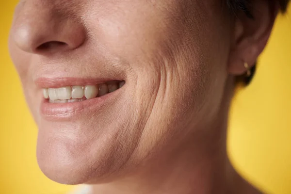 Cropped Image Mature Woman Toothy Smile — Stock Photo, Image