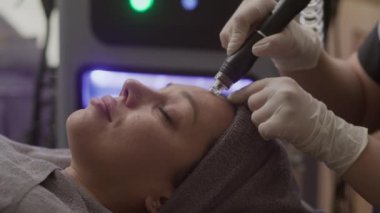 Klinikteki kadın müşterinin yüz derisi üzerinde mikronelleme aleti kullanan tanınmayan bir estetisyenin elleri orta derecede kapalı.