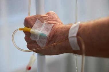 Elin damar yoluyla tıbbi tedavi gördüğü yakın plan görüntüsü, görünür bandaj damar yoluyla serumu emniyete alarak tıbbi prosedürün detaylarını gösteriyor.