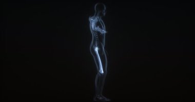 İnsan vücudunda uyluk. Röntgen. Döngü