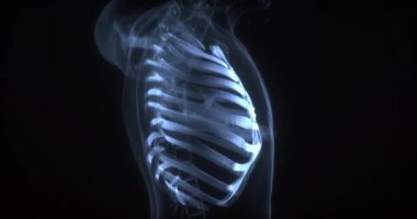 Göğüs yapısı, kaburgalar ve göğüs kafesi. Röntgen. Döngü