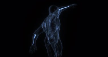 Ulna insan vücudunda. Röntgen. Döngü