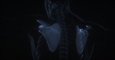 Kürek kemikleri insan vücudunda. Röntgen. Döngü