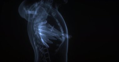 İnsan vücudunda serratus anterior kas. Röntgen. Döngü