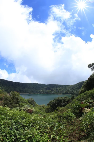 Laguna Pos Volcano National Park Surrounded Tropical Vegetation — Stock Photo, Image