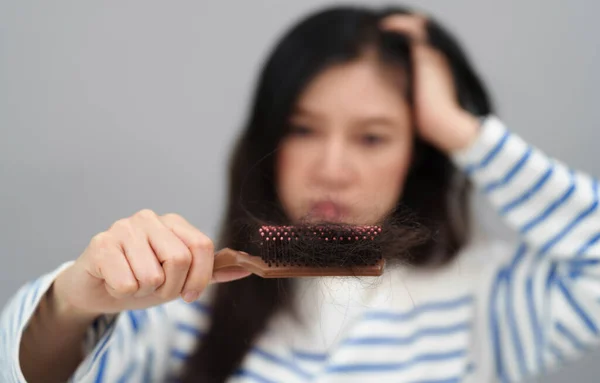 Femme Stressée Ayant Problème Perte Cheveux Avec Brosse Cheveux — Photo