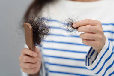 Saç fırçasıyla saç dökülme sorunu yaşayan bir kadın.